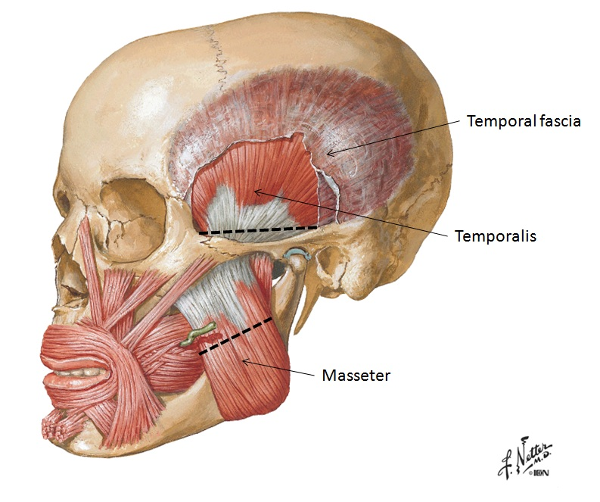 A cutaway image of the left side of the human skull, including the temoralis muscle
